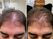 Kit Força & Crescimento SMÉROLA