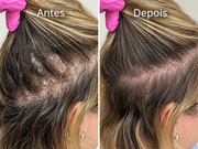 Kit Força & Crescimento SMÉROLA