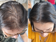 Kit Força & Crescimento SMÉROLA