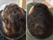 Shampoo Antiqueda Força & Crescimento SMÉROLA