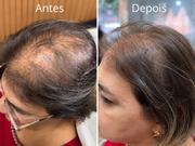 Kit Força & Crescimento SMÉROLA