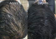 Shampoo Antiqueda Força & Crescimento SMÉROLA