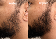 Kit Força & Crescimento SMÉROLA