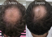 Kit Força & Crescimento SMÉROLA